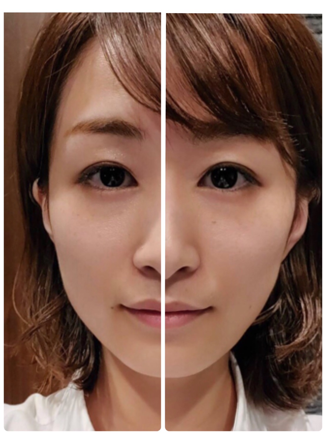台湾 美顔器 電気バリブラシ Dr. Arrivo 〈理容室/床屋/台北〉|ブログ