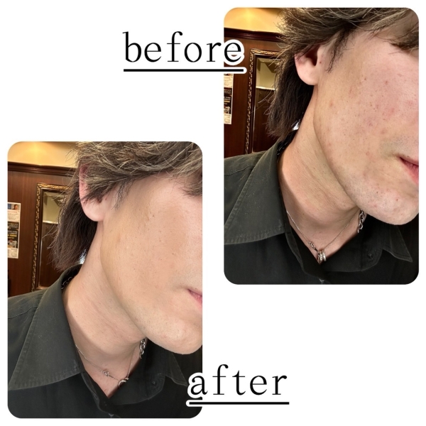 BBクリームの秋