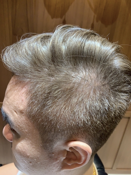 經典的變化型