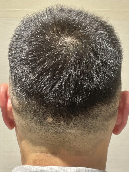 スキンフェード