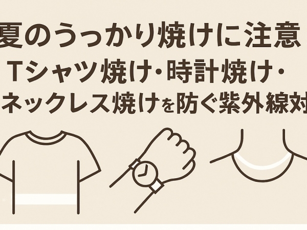 夏のうっかり焼けに注意！