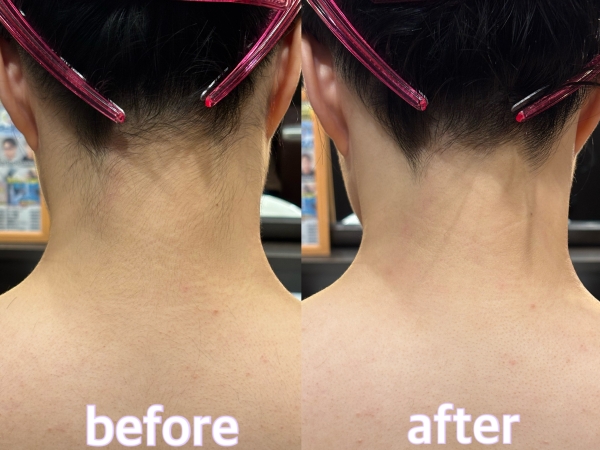 明けましておめでとうございます！レディースシェービング