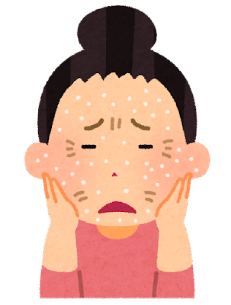 乾燥対策大丈夫ですか！？