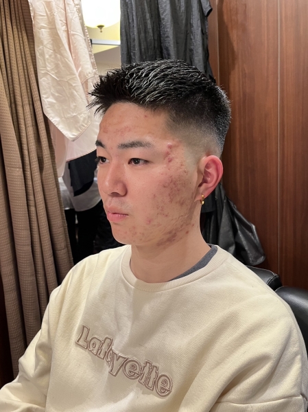 スキンフェード