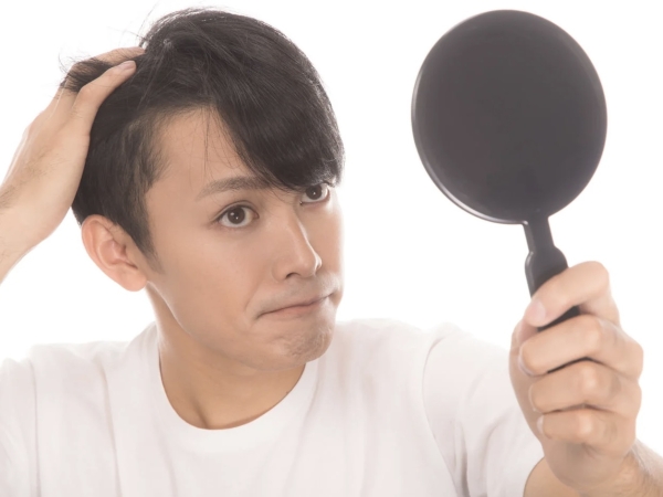 20代で始める薄毛予防の秘訣