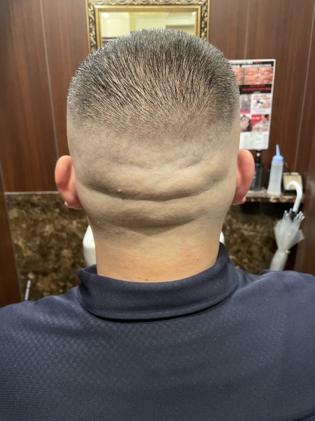 スキンフェード