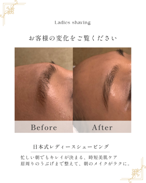 【スキンケア】ホーチミンで叶える、レディースシェービング